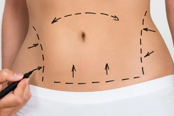 How is a tummy tuck and hair transplant helpful for people