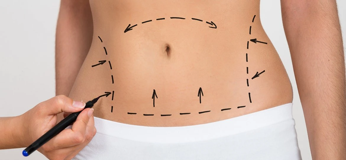 How is a tummy tuck and hair transplant helpful for people