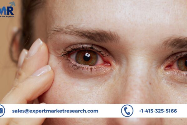 Sjogren's Syndrome Treatment Market