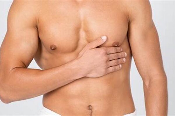 Expert Guide to Male Chest Reduction Surgery in Ludhiana and Liposuction in Chandigarh