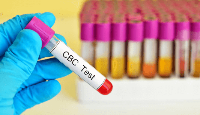 cbc test in hyderabad