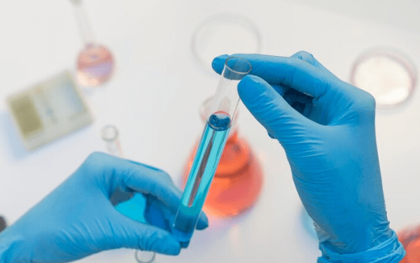 Lipid Profile Test