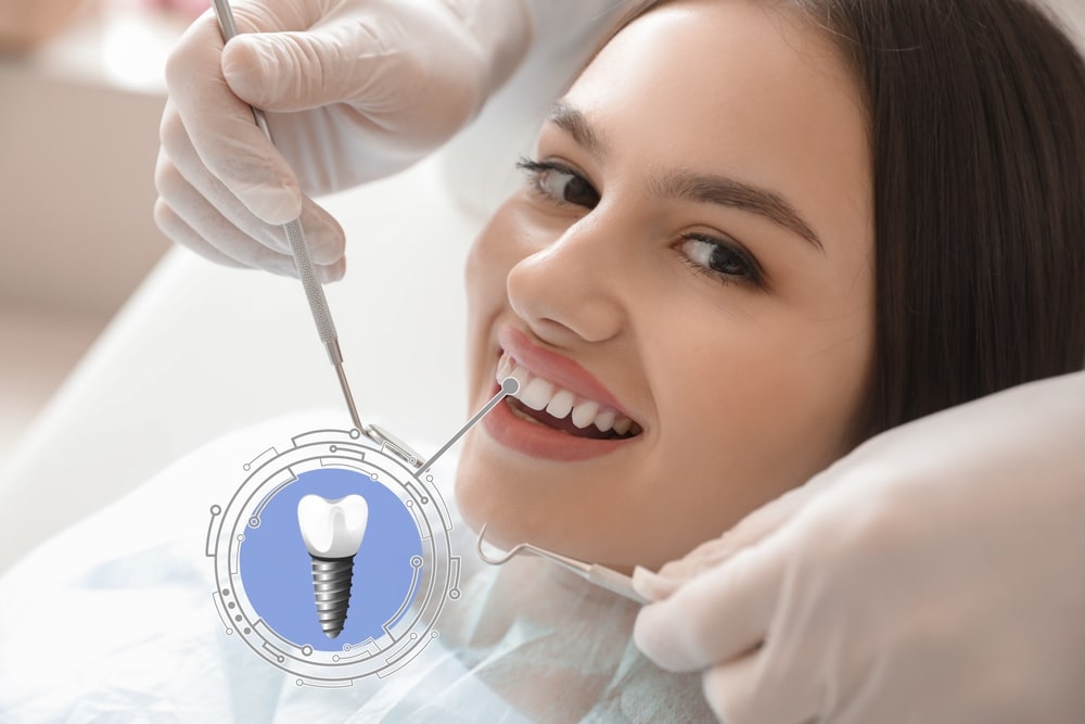 low cost dental implants uk